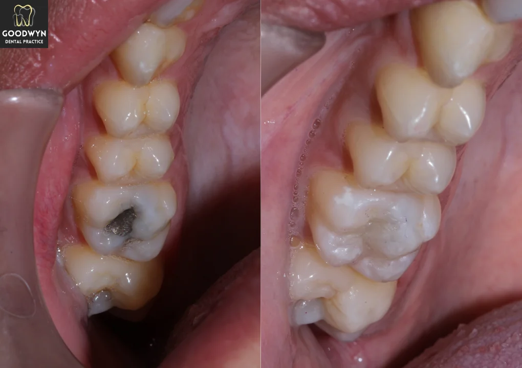 2nd Draft images before & After (3)