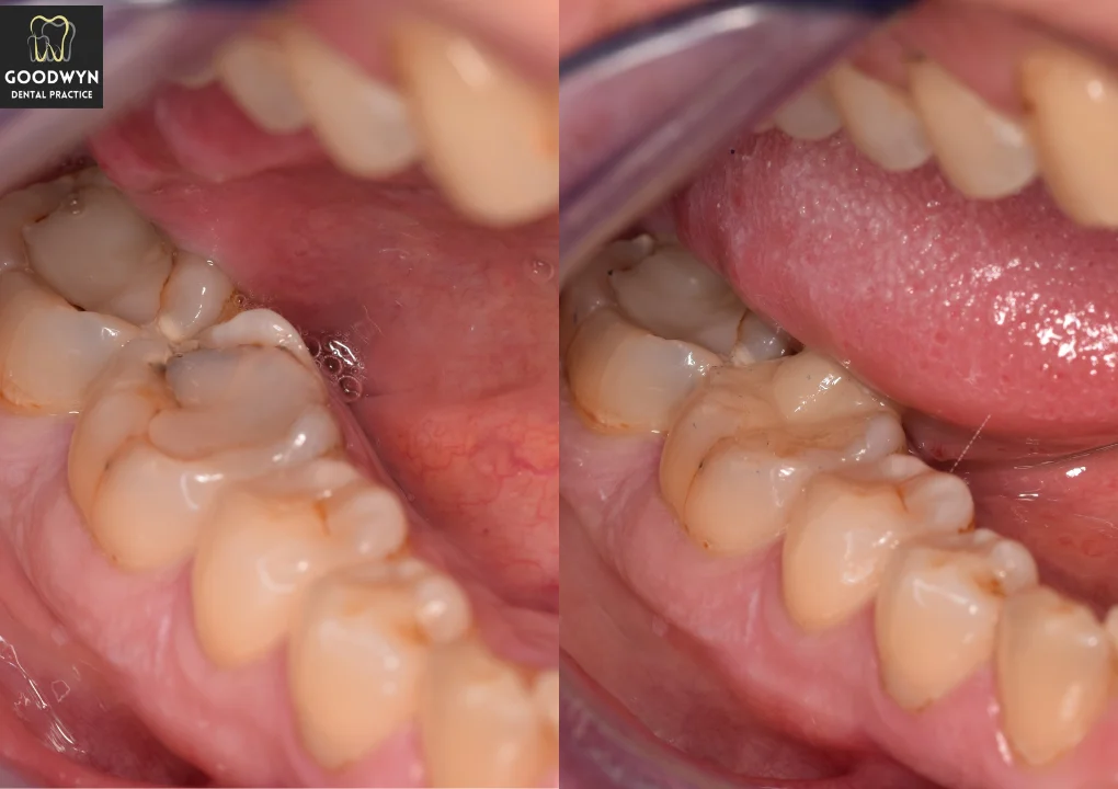 2nd Draft images before & After (4)